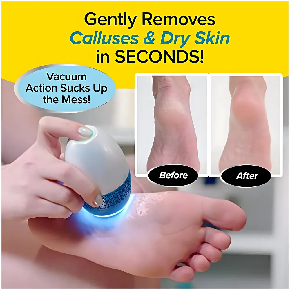 Professional Callus Remover Filer Pedicure Device for Feet with Built-in Vacuum Electric Callus Remover for Mess-Free Exfoliation Foot File Removes Dead Skin from Feet.