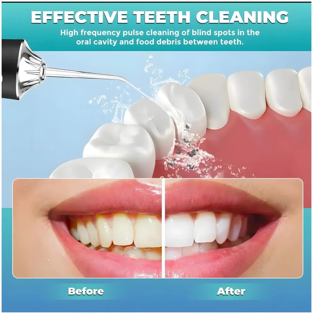 Black Water Flosser Portable Dental Water Jet Oral Teeth Irrigator Waterproof Tooth Cleaner Water Flosser Oral Flosser 3 Modes And 4 Nozzels 220 ML