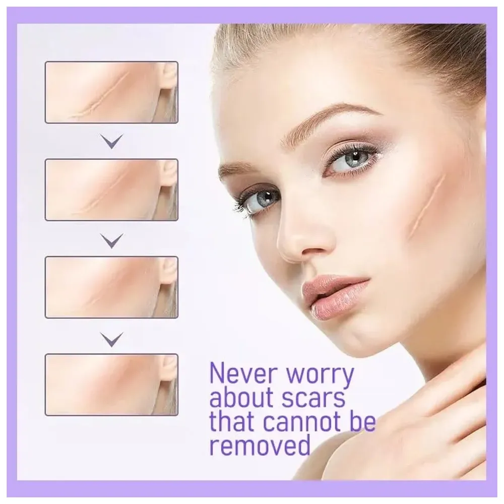 Bioline Clear Silicon Scar Sheet 4 x 150 Cm for Healing Scars Transparent tear silicone tape roll for hypertrophic scars and keloids caused by surgery, medical silicone for scar removal