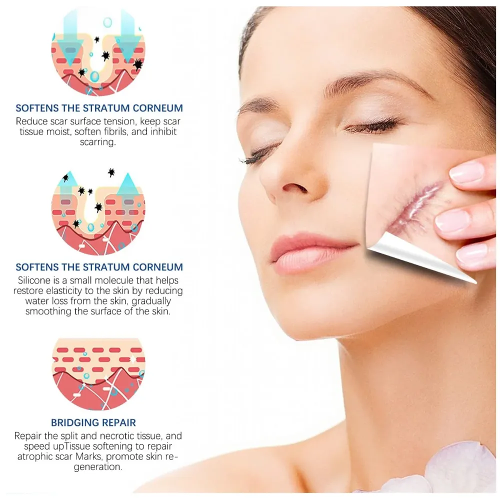 Bioline Silicon Scar Sheet 4 x 150 Cm for Healing Scars Transparent tear silicone tape roll for hypertrophic scars and keloids caused by surgery, medical silicone for scar removal - 3