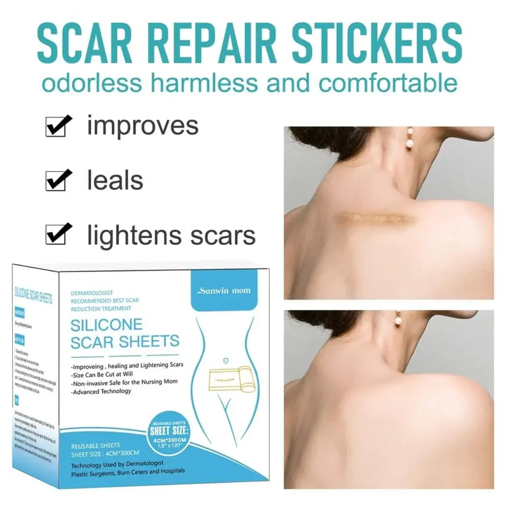 Bioline Silicon Scar Sheet 4 x 150 Cm for Healing Scars Transparent tear silicone tape roll for hypertrophic scars and keloids caused by surgery, medical silicone for scar removal - 6