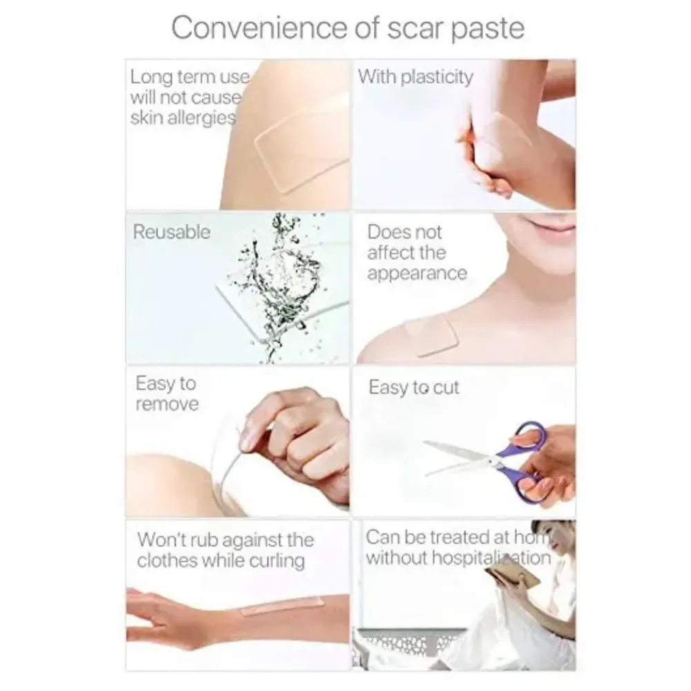 Bioline Silicon Scar Sheet 4 x 150 Cm for Healing Scars Transparent tear silicone tape roll for hypertrophic scars and keloids caused by surgery, medical silicone for scar removal - 8