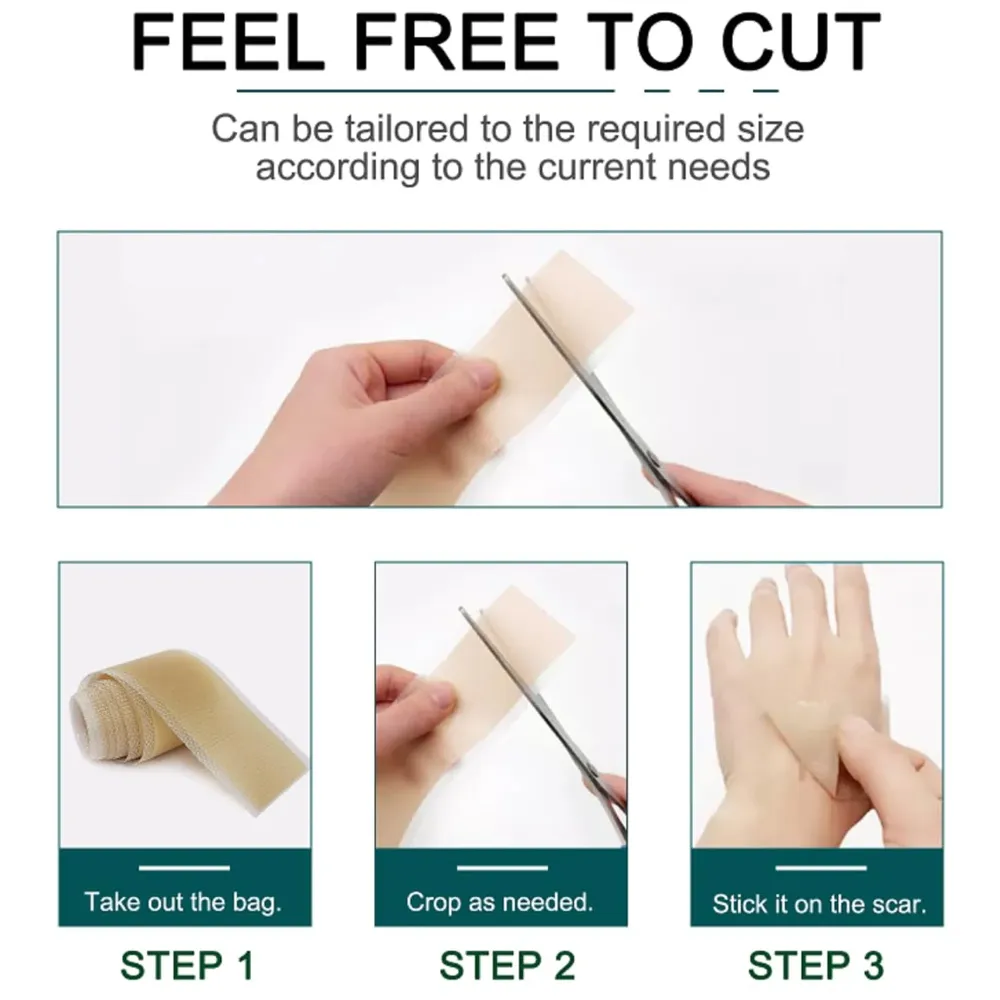 Bioline Silicon Scar Sheet 4 x 150 Cm for Healing Scars Transparent tear silicone tape roll for hypertrophic scars and keloids caused by surgery, medical silicone for scar removal - 9