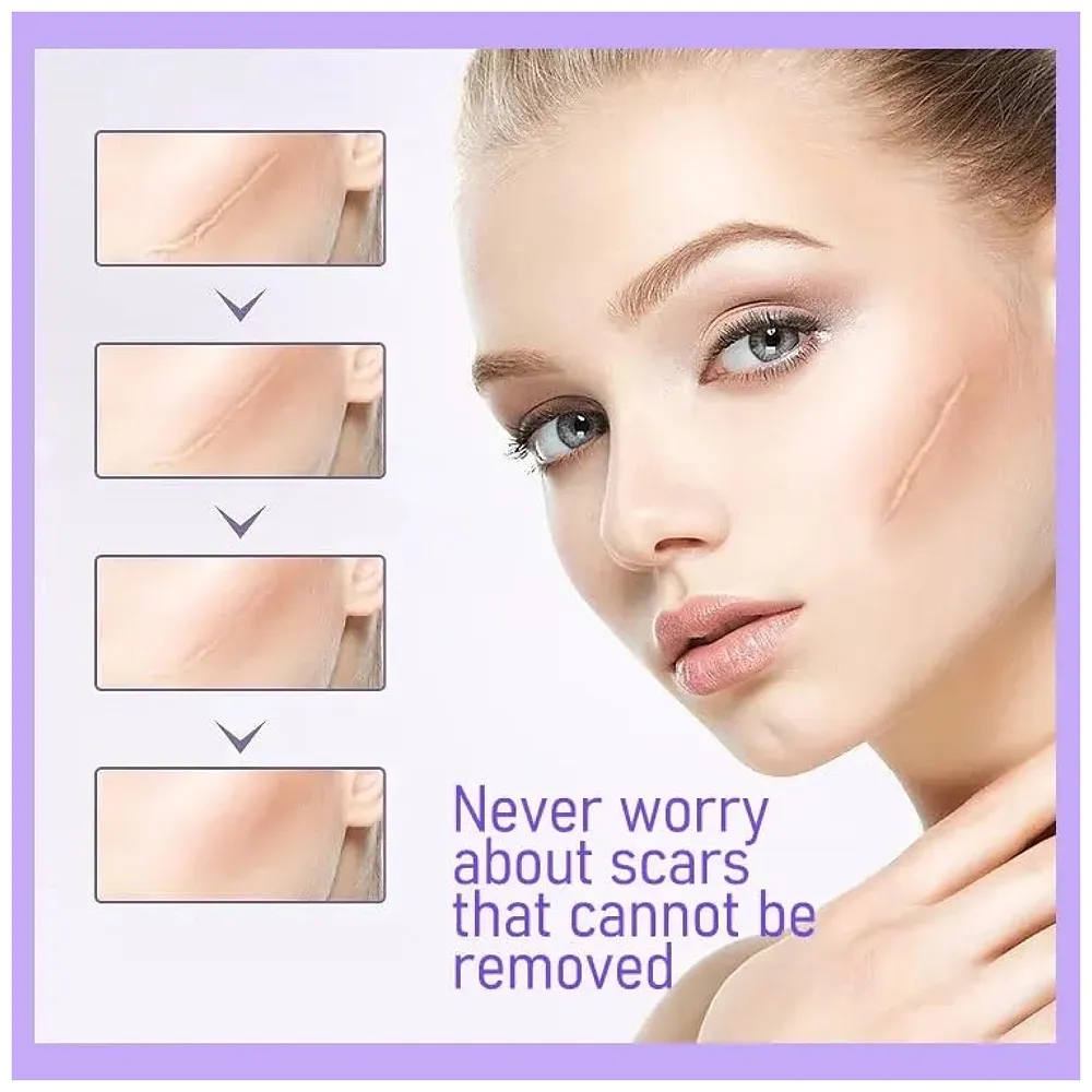 Silicon Scar Sheet 4 x 150 Cm for Healing Scars Transparent tear silicone tape roll for hypertrophic scars and keloids caused by surgery, medical silicone for scar removal