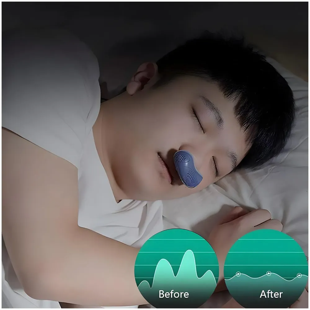 Bioline Upgraded Electric Noise Anti Snoring Device Sleep Stop Snore Aid Stopper, Stop Snoring Aids Devices Solution Small Travel - 6